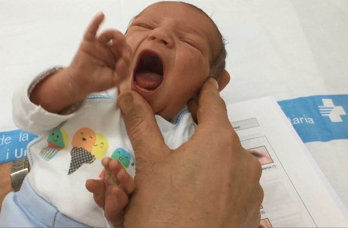 diagnostico-anquiloglosia-e1545572926138.jpg